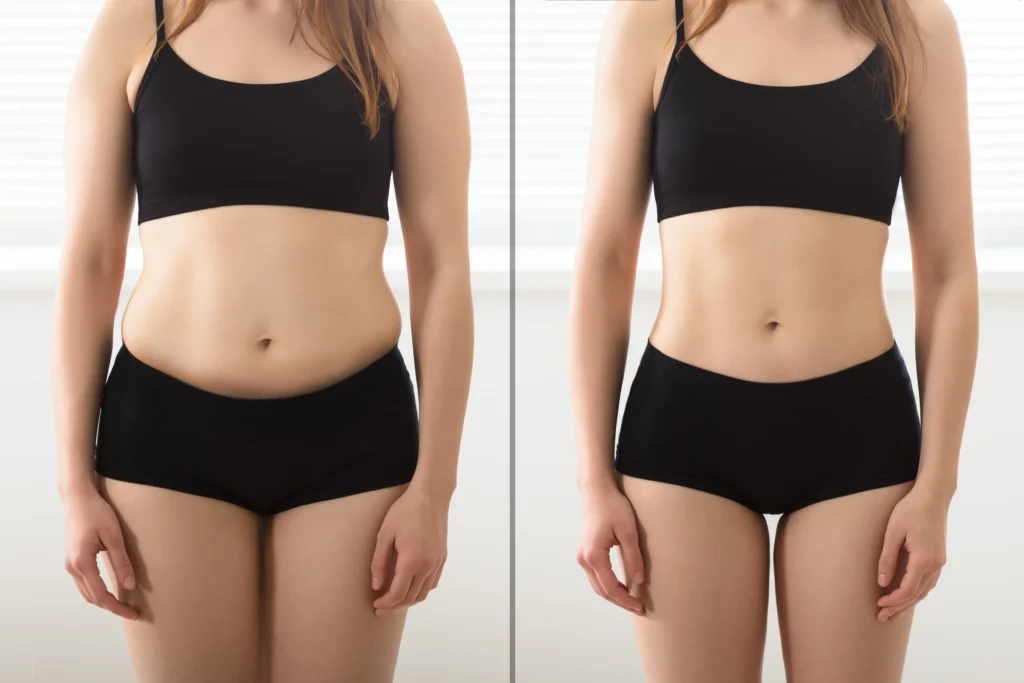 Injectables at Contours in Lakewood