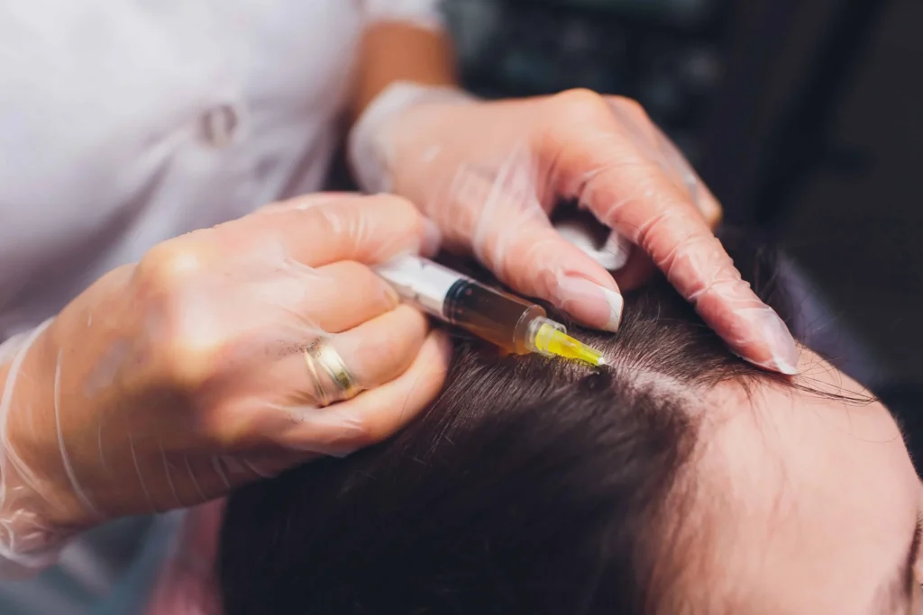 Hair Restoration at Contours in Lakewood
